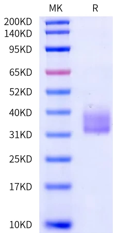 Bis-Tris PAGE Data