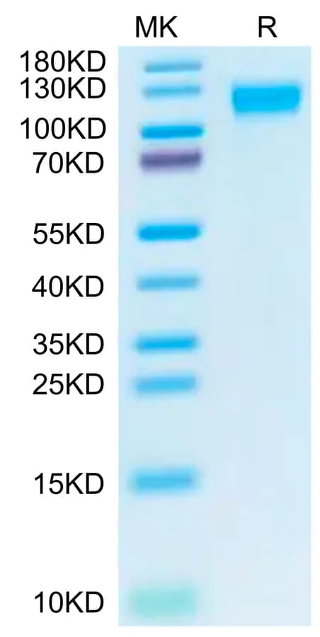 Bis-Tris PAGE Data