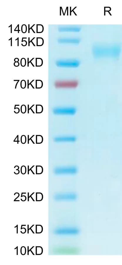 Bis-Tris PAGE Data