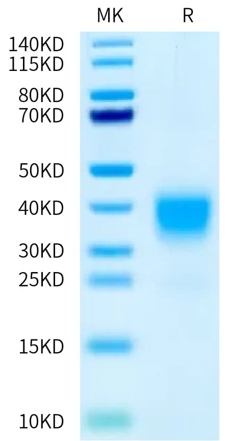 Bis-Tris PAGE Data