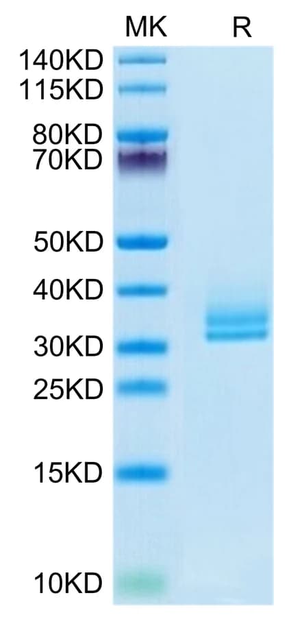 Bis-Tris PAGE Data