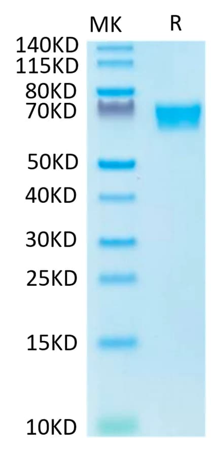 Bis-Tris PAGE Data