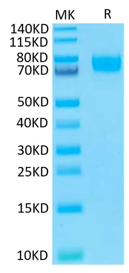 Bis-Tris PAGE Data