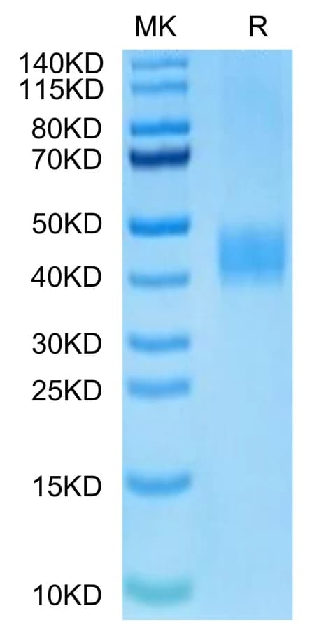 Bis-Tris PAGE Data
