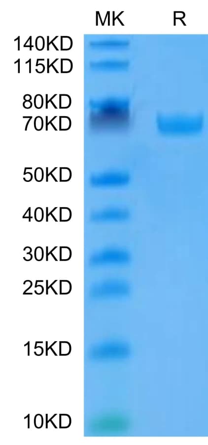 Bis-Tris PAGE Data