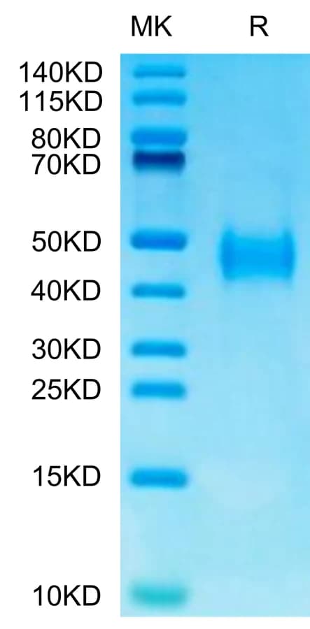 Bis-Tris PAGE Data