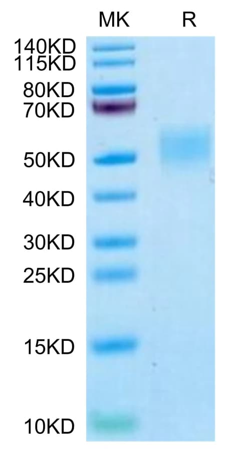 Bis-Tris PAGE Data