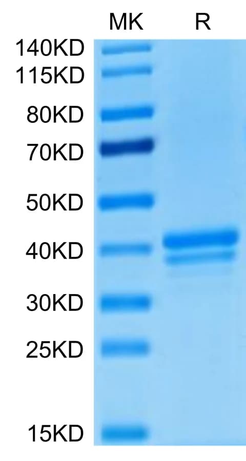 Bis-Tris PAGE Data