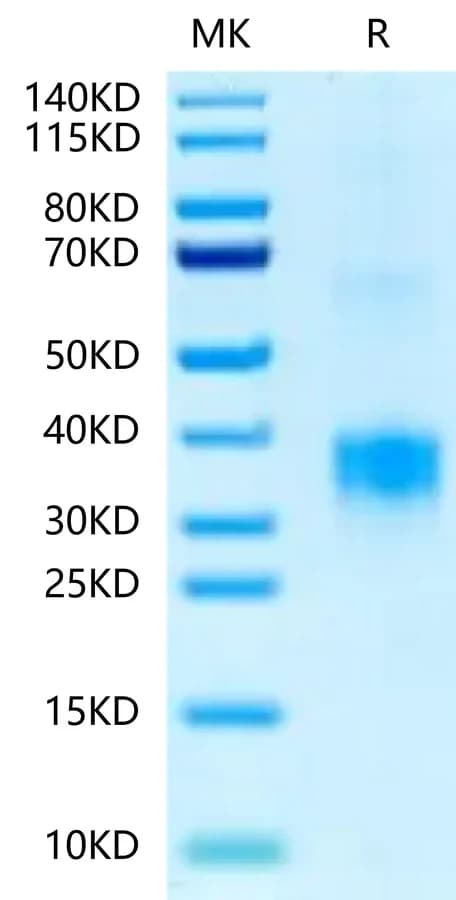 Bis-Tris PAGE Data