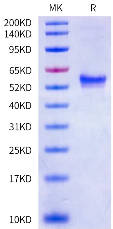 Bis-Tris PAGE Data