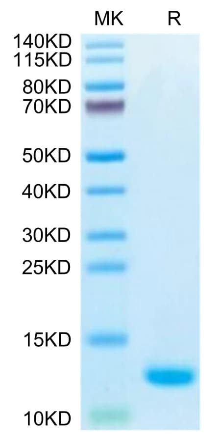 Bis-Tris PAGE Data
