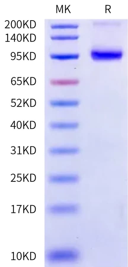 Bis-Tris PAGE Data