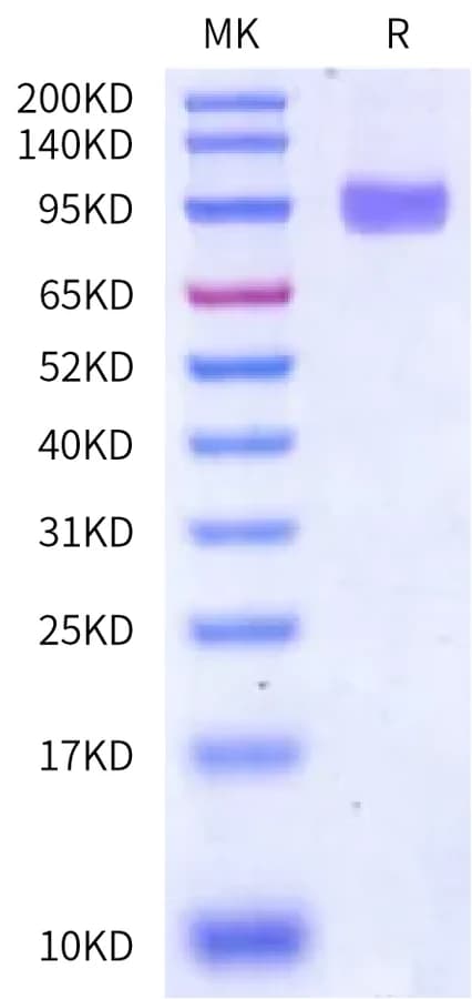 Bis-Tris PAGE Data