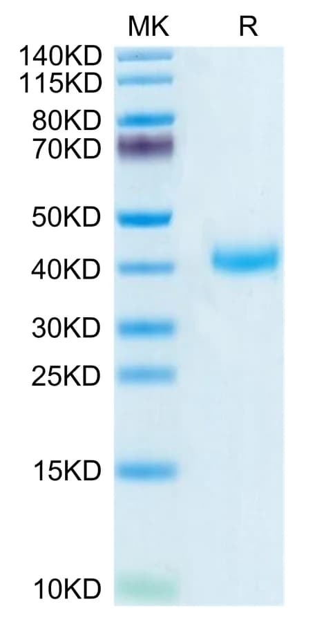 Bis-Tris PAGE Data