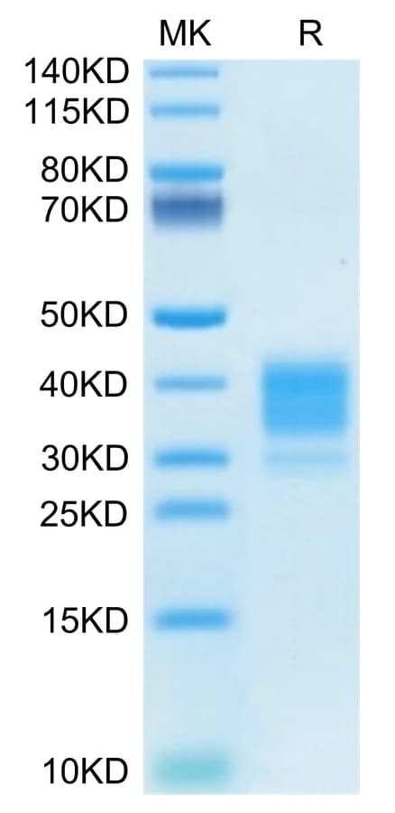 Bis-Tris PAGE Data