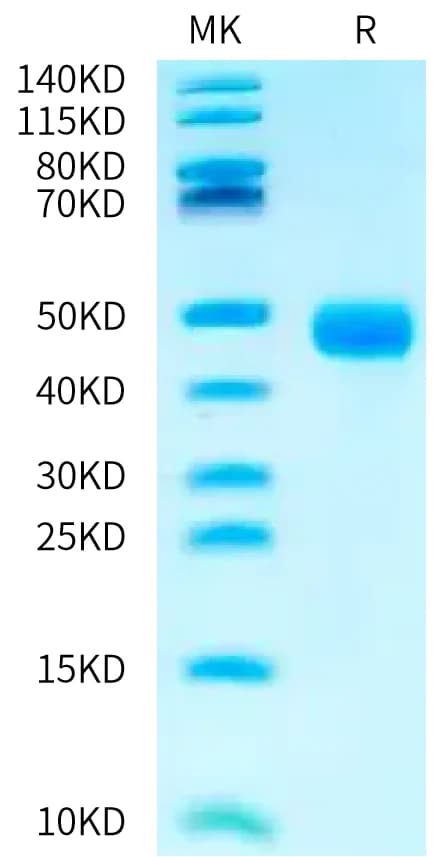 Bis-Tris PAGE Data