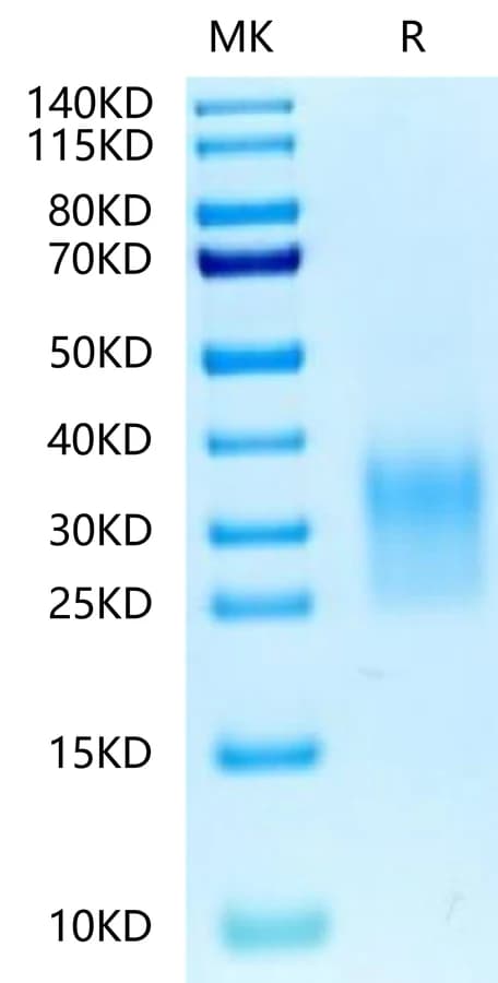 Bis-Tris PAGE Data