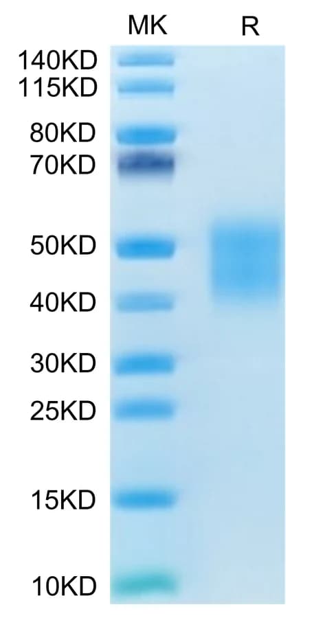 Bis-Tris PAGE Data