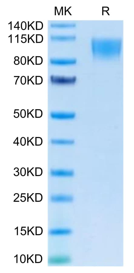 Bis-Tris PAGE Data