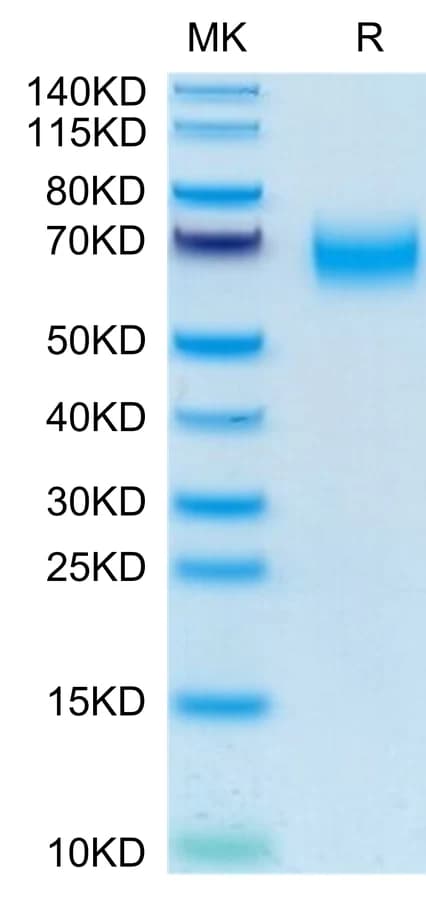 Bis-Tris PAGE Data