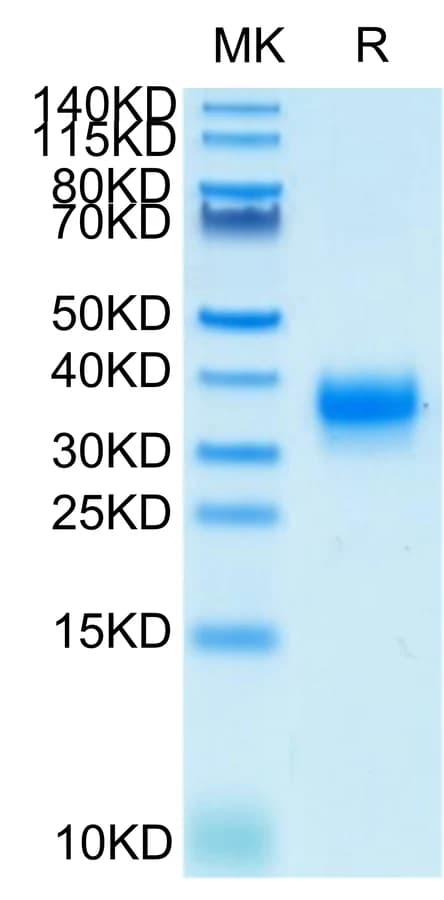 Bis-Tris PAGE Data