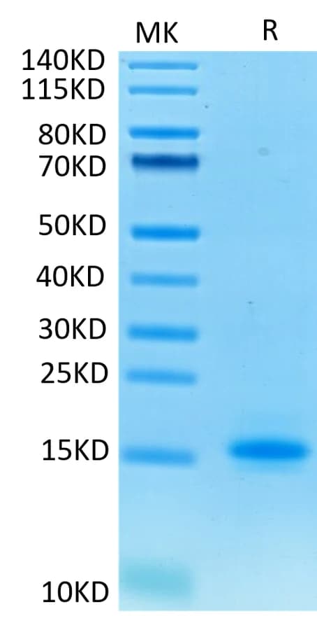 Bis-Tris PAGE Data