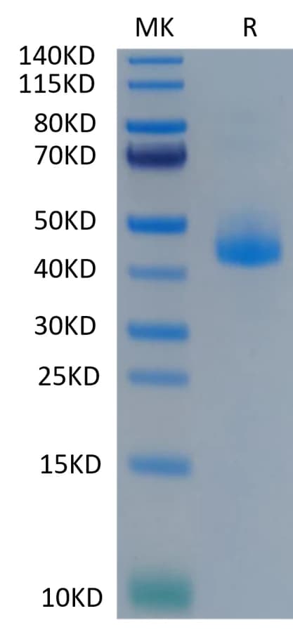 Bis-Tris PAGE Data