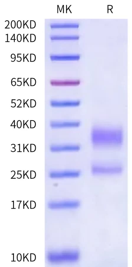 Bis-Tris PAGE Data