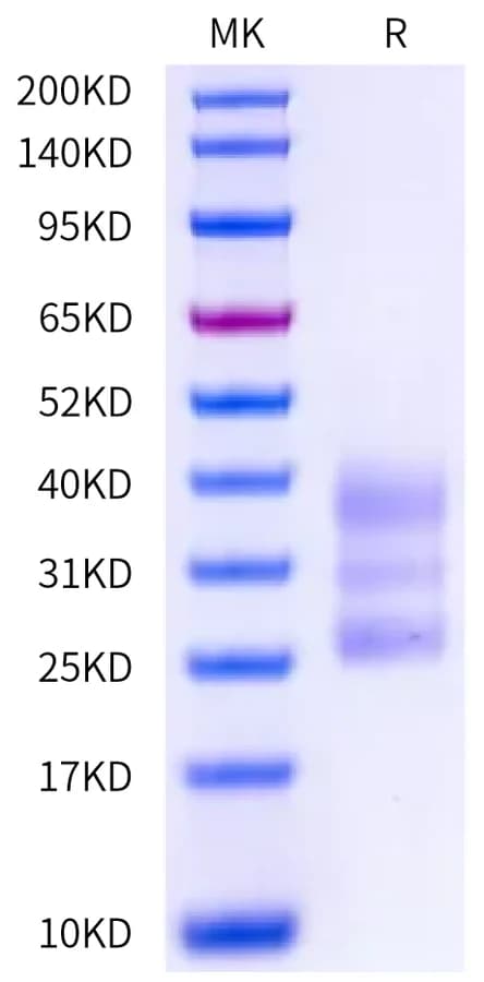 Bis-Tris PAGE Data