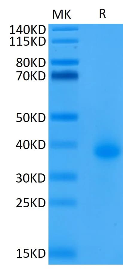 Bis-Tris PAGE Data