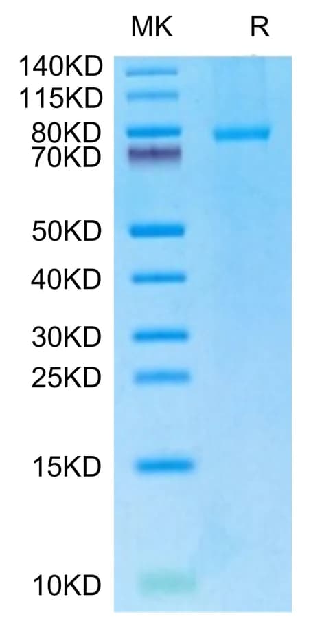 Bis-Tris PAGE Data