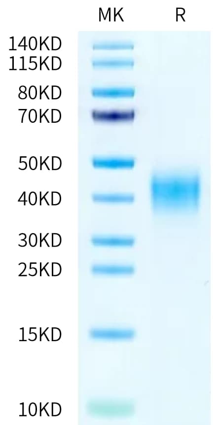 Bis-Tris PAGE Data