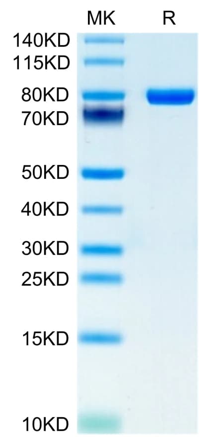 Bis-Tris PAGE Data