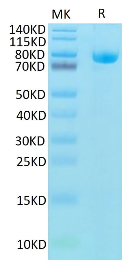 Bis-Tris PAGE Data