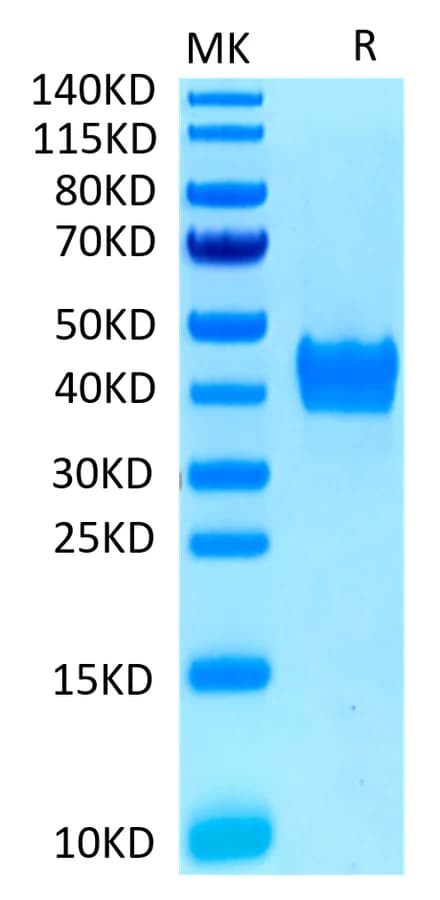 Bis-Tris PAGE Data