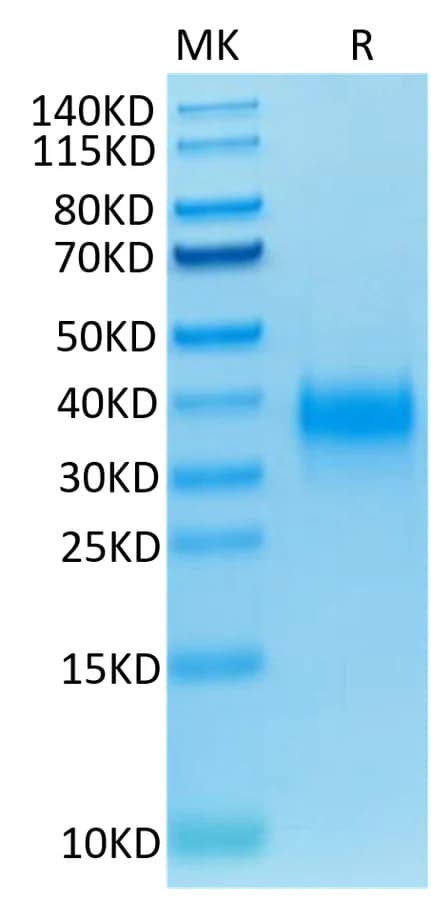 Bis-Tris PAGE Data