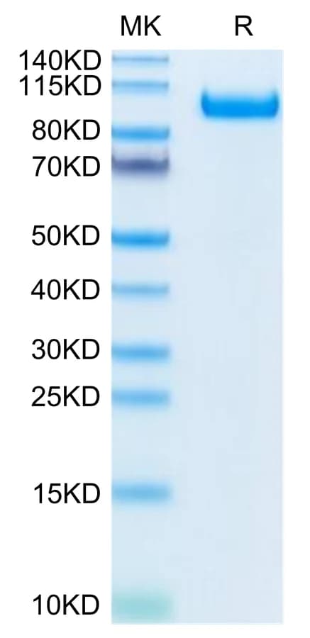 Bis-Tris PAGE Data