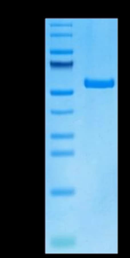 Bis-Tris PAGE Data