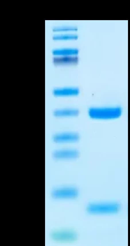 Bis-Tris PAGE Data