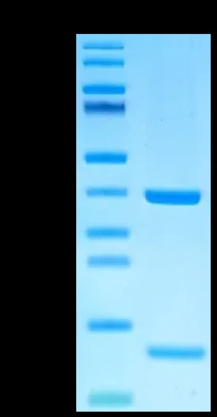 Bis-Tris PAGE Data