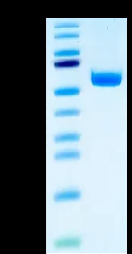 Bis-Tris PAGE Data