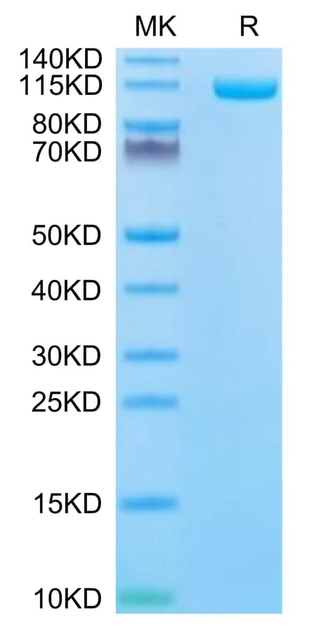 Bis-Tris PAGE Data