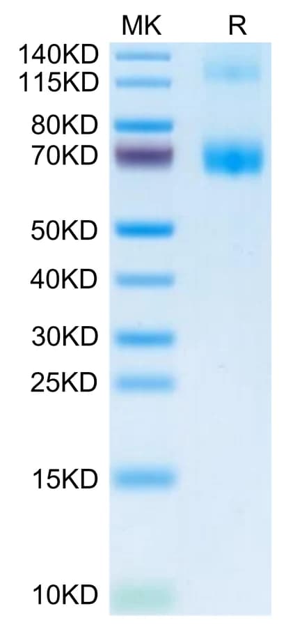 Bis-Tris PAGE Data