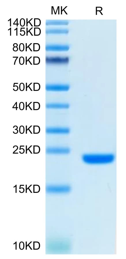Bis-Tris PAGE Data