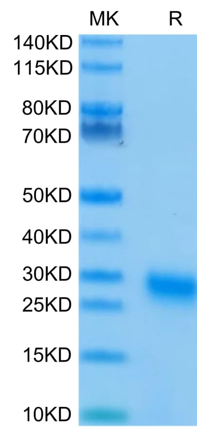 Bis-Tris PAGE Data