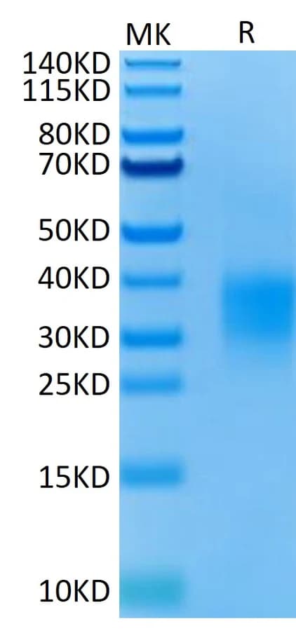 Bis-Tris PAGE Data