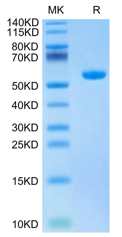 Bis-Tris PAGE Data