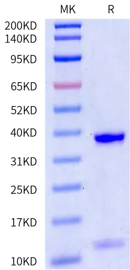 Bis-Tris PAGE Data