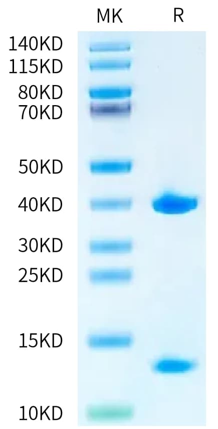 Bis-Tris PAGE Data
