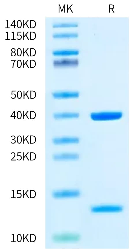 Bis-Tris PAGE Data